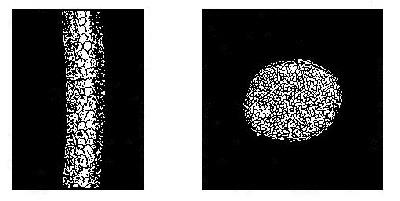 MICROSCOPIC APPEARANCE OF WOOL FIBERS