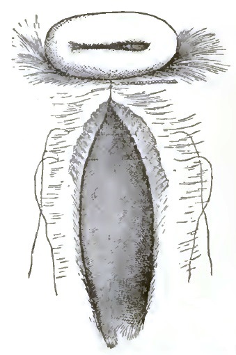 After twisting of the first suture