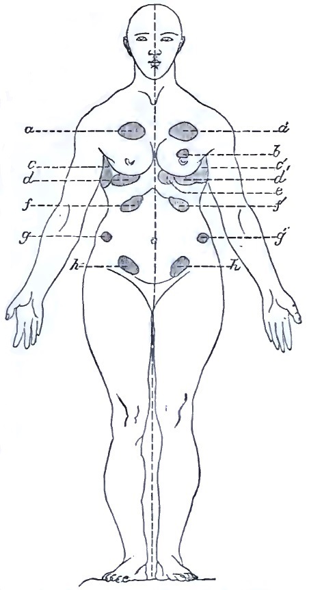 Anterior hysterogenic zones