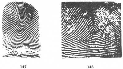 Figs. 147-148