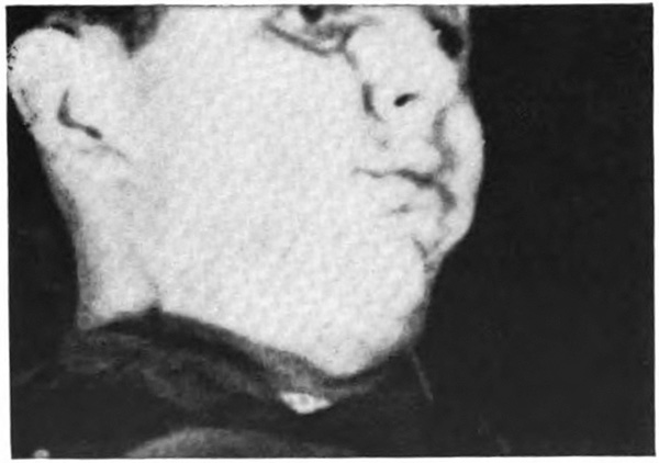 Pictures of a man's swollen and bloody face