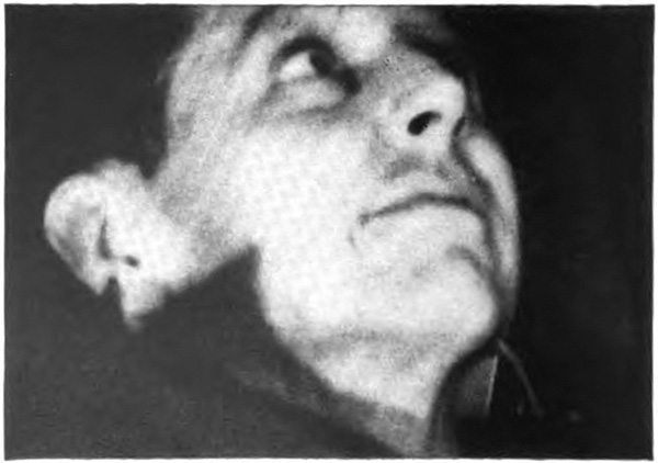 Pictures of a man's swollen and bloody face